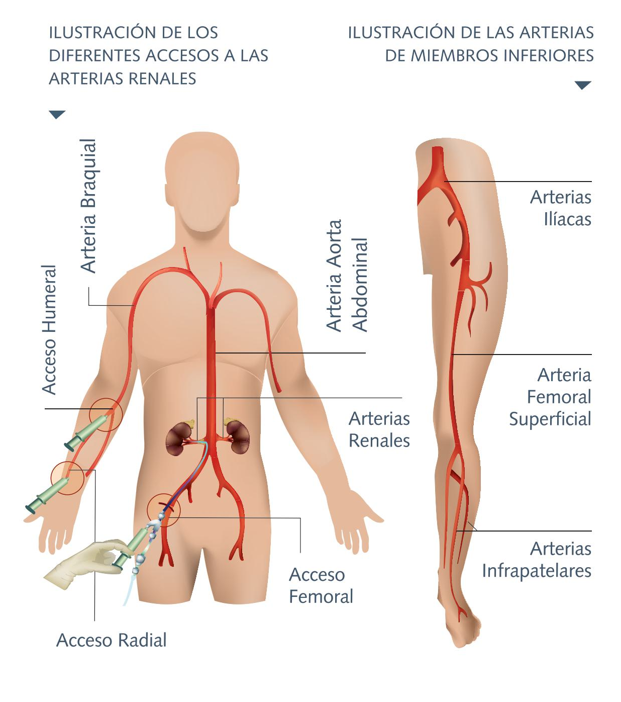 hemodinamia