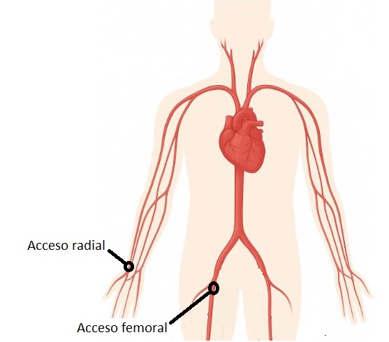 accesos