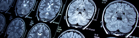 neuroimágenes