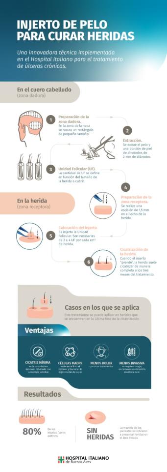 infografia
