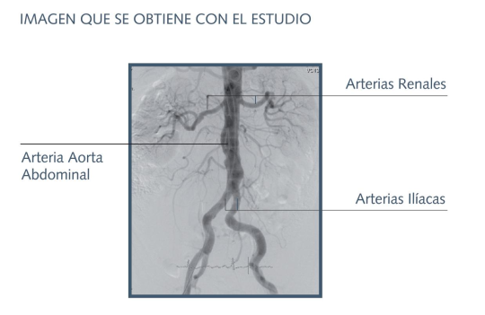 hemodinamia