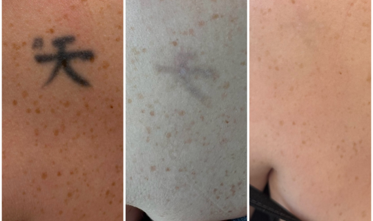 Estetica y Laser