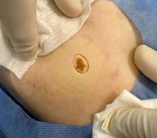 Dermatología