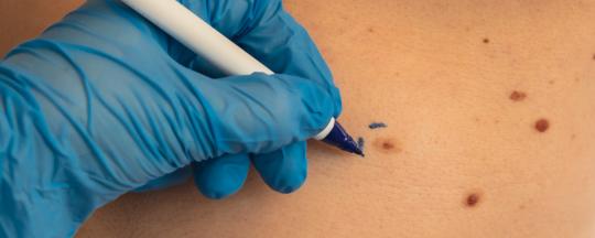 Dermatología