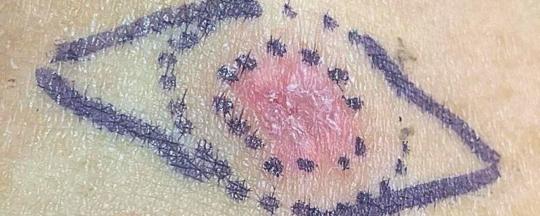 Dermatología