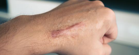 Dermatología