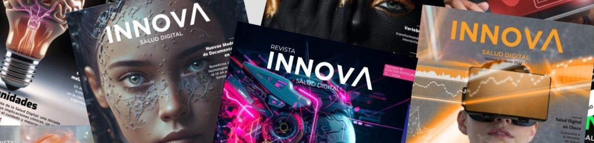 innova30
